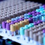 The Benefits and Challenges of Pre-Employment Drug Testing